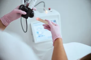 Laser íntimo CO₂: 7 pontos para avaliar antes de fazer