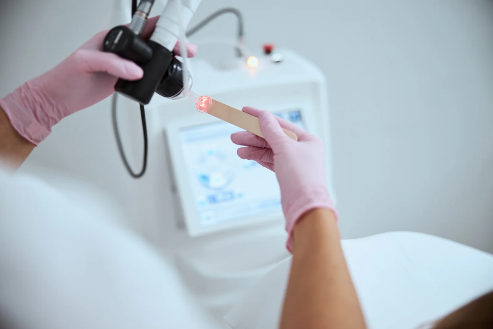 Laser íntimo CO₂: 7 pontos para avaliar antes de fazer